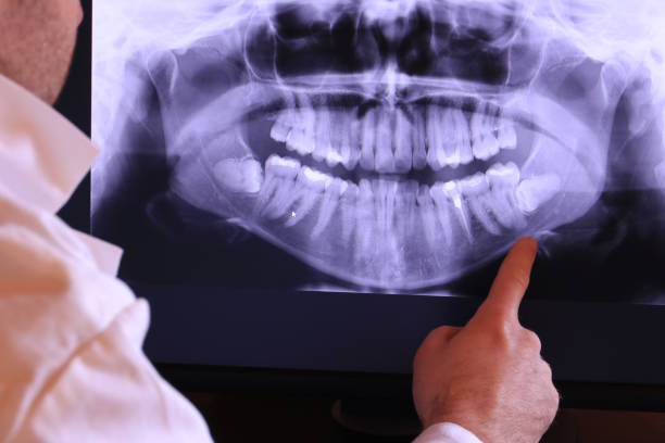 Best Emergency Root Canal Therapy in Greenbrier, TN