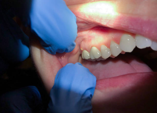 Best Emergency Denture Repair in Greenbrier, TN